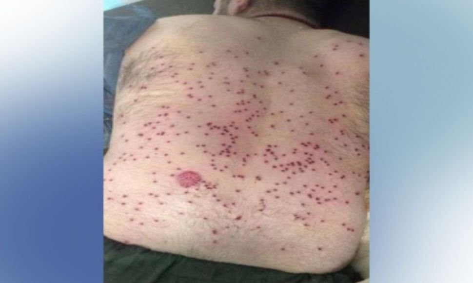 At the Baneh border, military forces fired on a Kolbar, resulting in injury