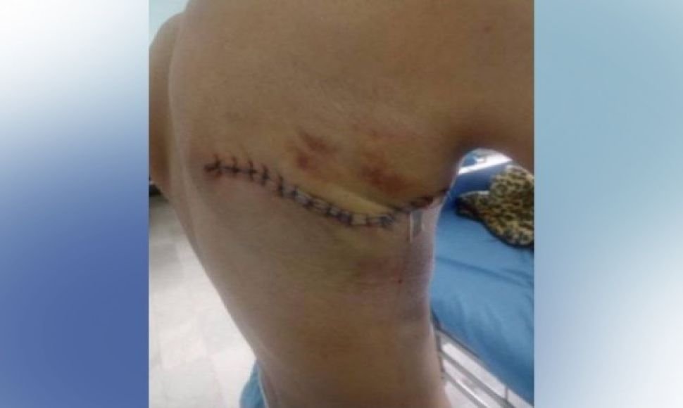 Marivan; Injuring a 16-year-old ber due to the shooting of military forces