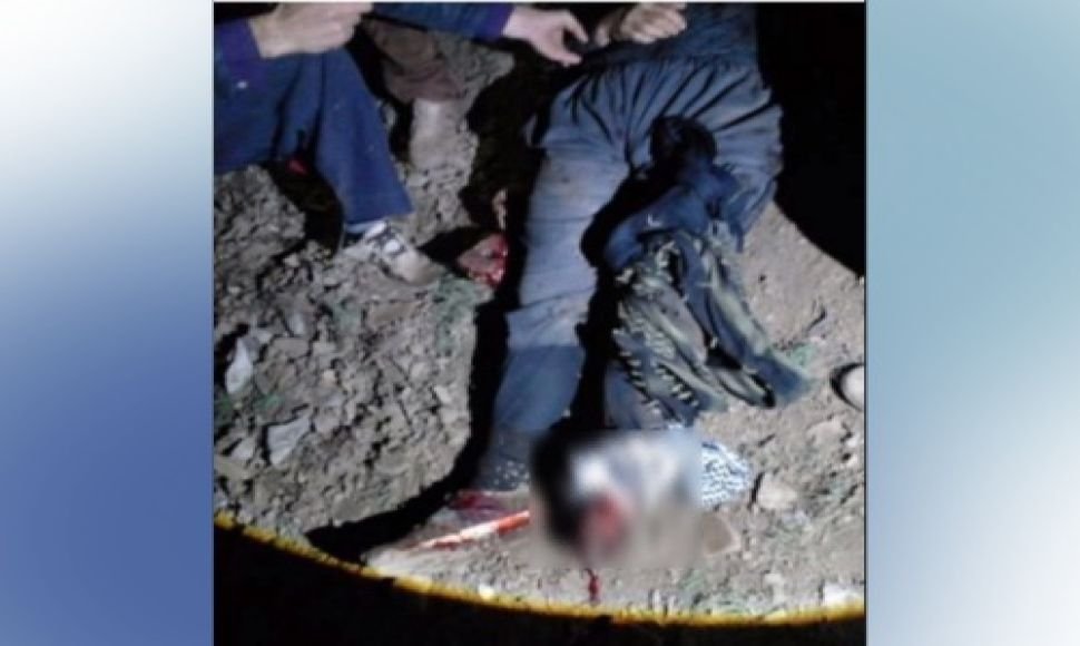 A mine explosion disabled the limb of a Kolber