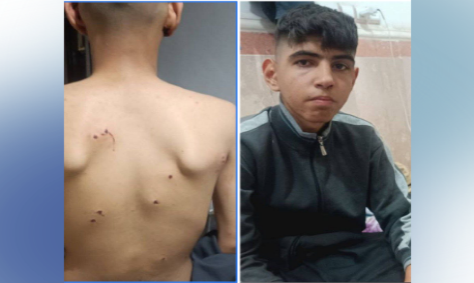 Two underage Kolbers were injured by military forces in Baneh