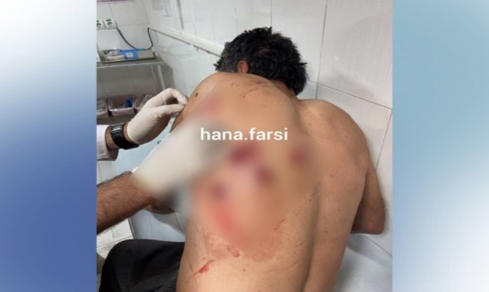 15 Kolber  were injured by military forces at the border of Nosud