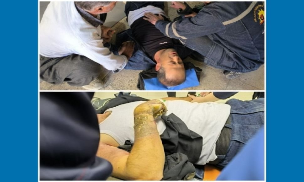A workplace accident caused severe injury to a worker