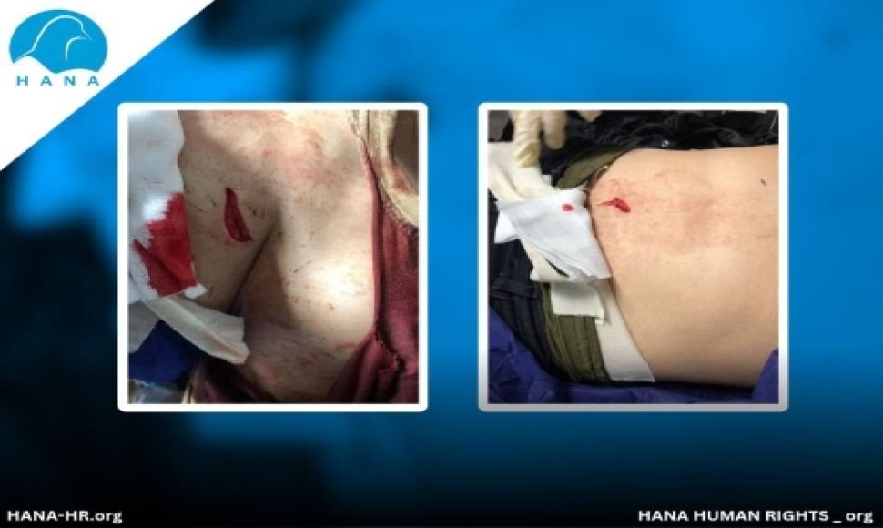Female citizen stabbed by her husband over divorce request