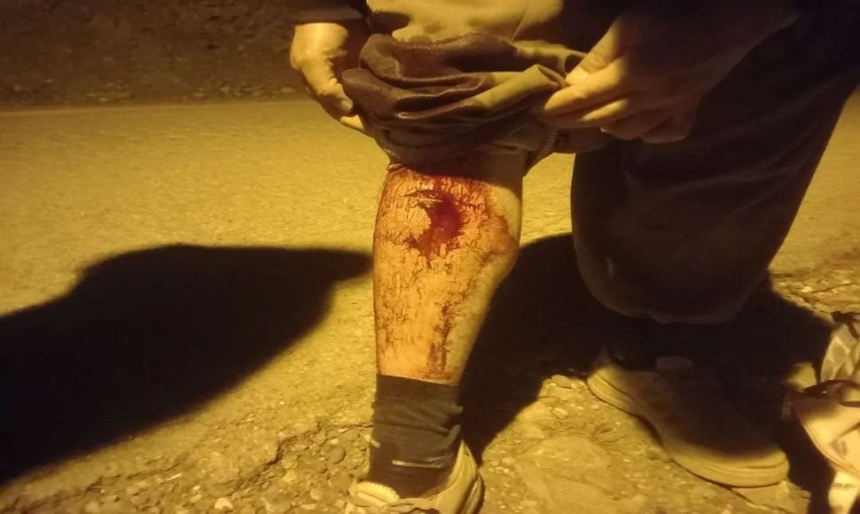 Nosud: A Kolber was stabbed by the border regiment and beaten
