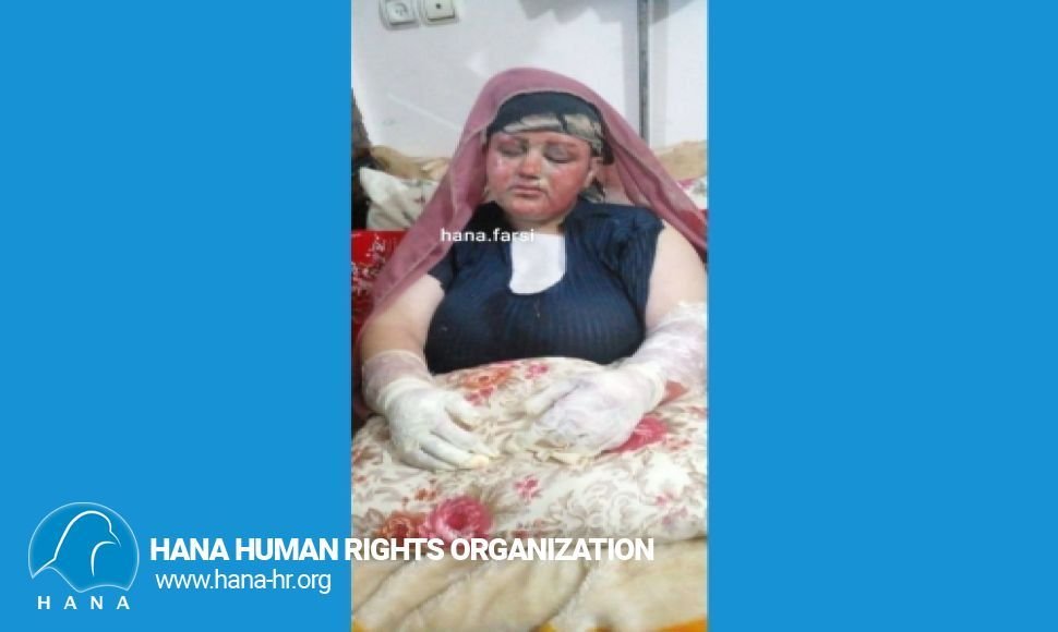 A woman was set on fire by her husband in Selmas