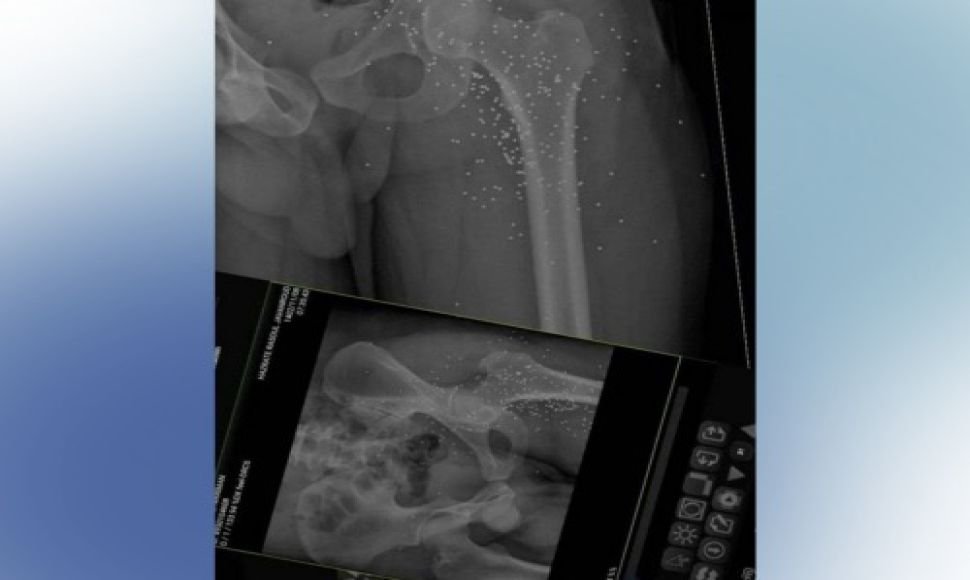 Nosud:  A Kolber was injured by military forces