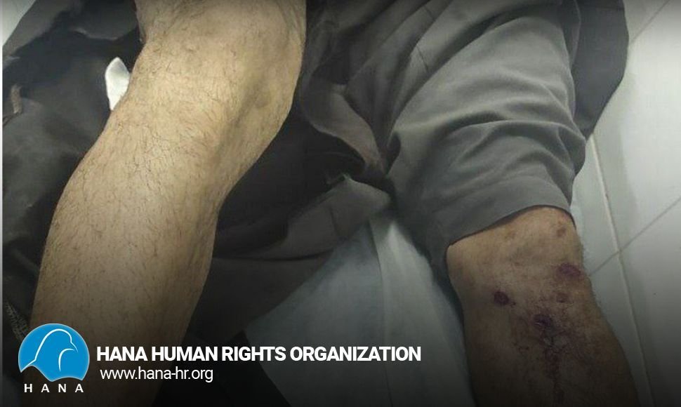 A Kolber was injured in Nosud