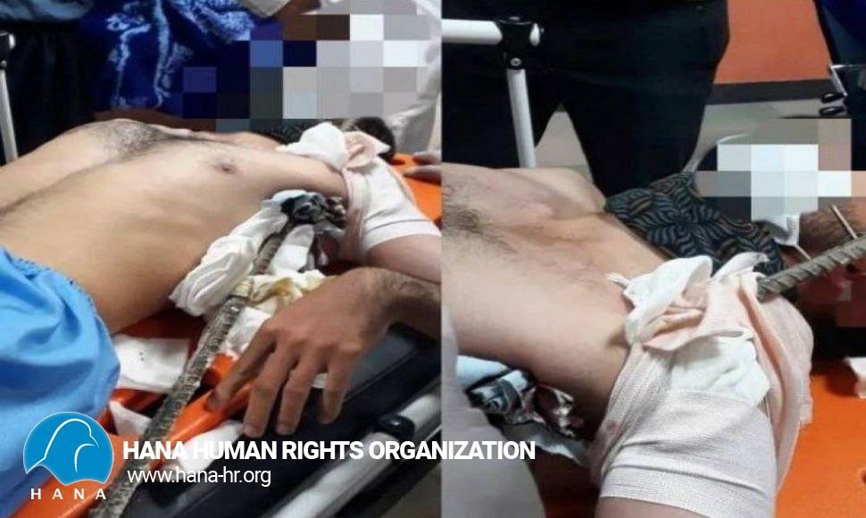 Bukan / A worker is injured in a work accident