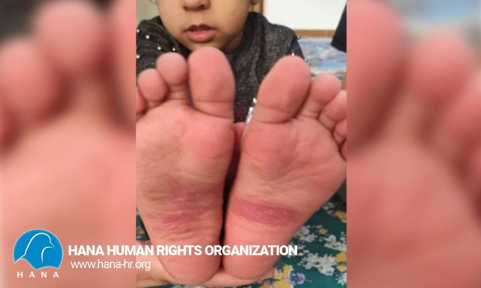 Child abuse of a Saqqez girl by her step-aunt