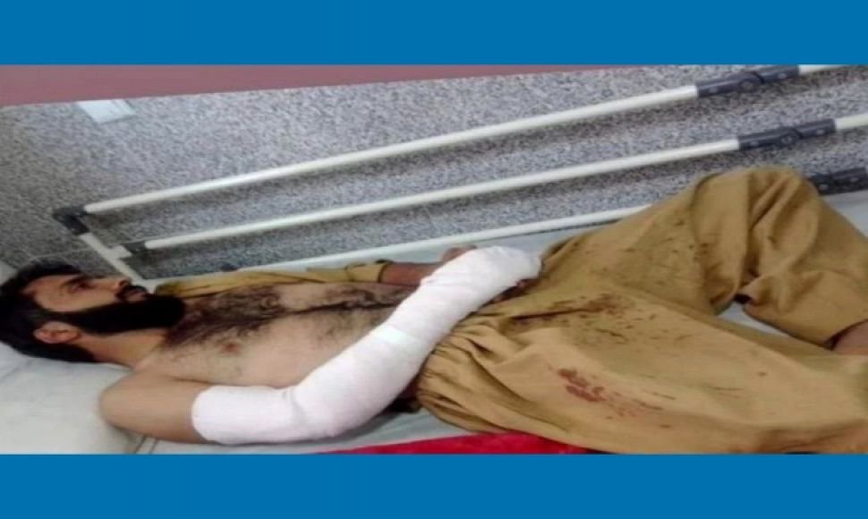 Banah; A Kolbar was wounded by gunfire from the military