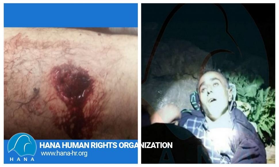 Several Kolbars killed and wounded in Nosud